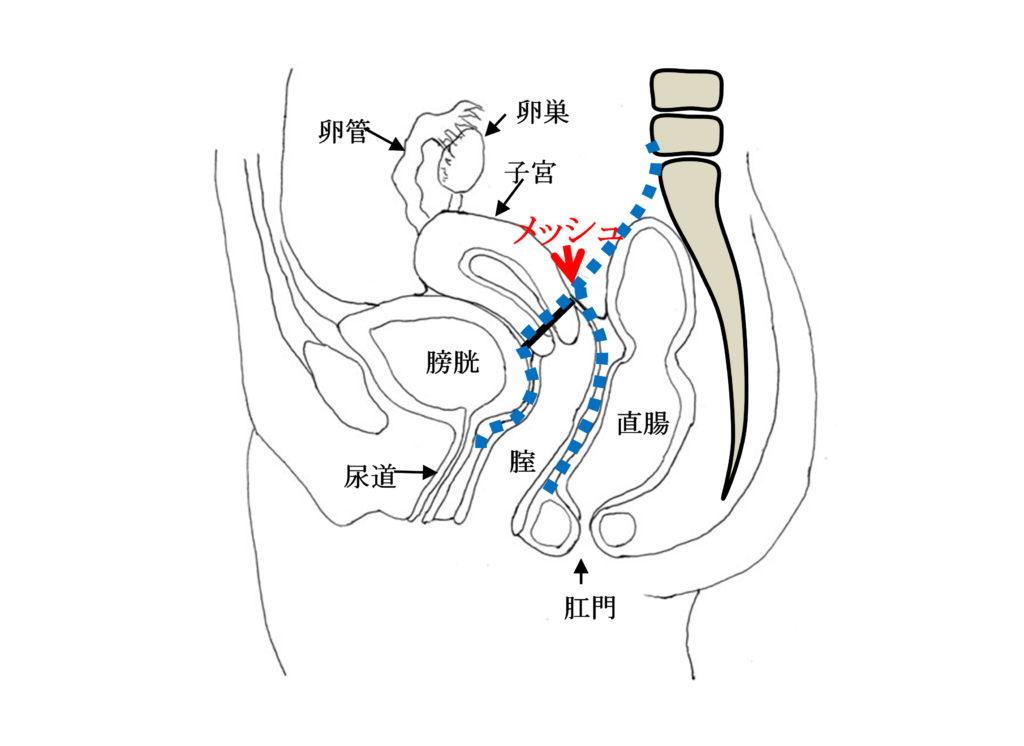 LSC のメッシュ位置 