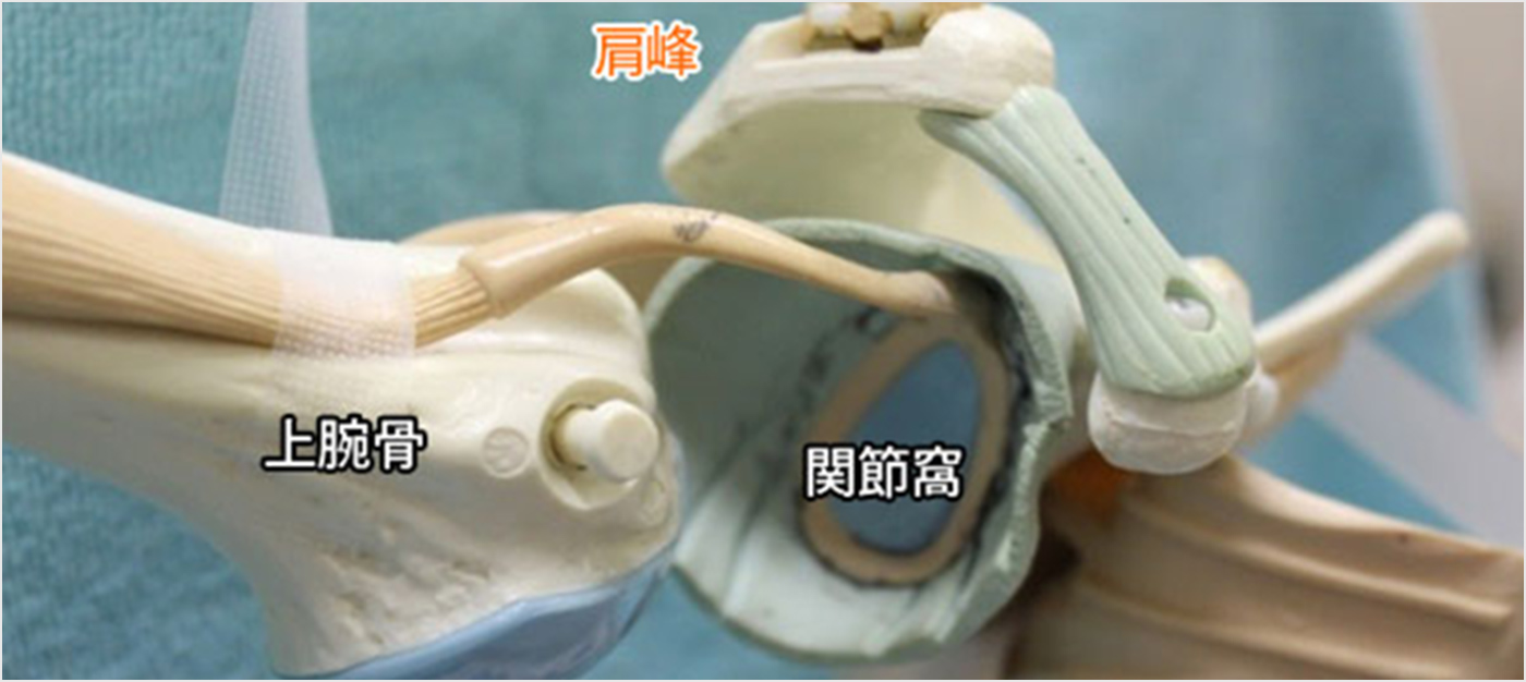 図1c.腕の骨を外したところ