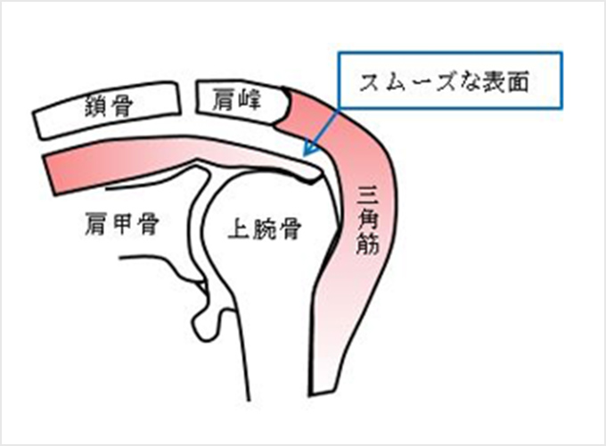 図3a.正常な状態